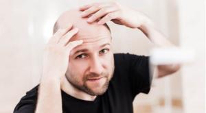 קרחת צילום: shutterstock פרשת מצורע