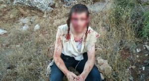 הצעיר שהותקף בבנימין צילום: חוננו חדשות