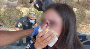 תיעוד התקיפה צילום: דוברות המשטרה חדשות