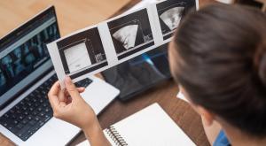 ייעוץ גנטי להפלות חוזרות |  צילום: olgsera,Shutterstock כדאי לדעת