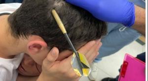 הנער שחץ נתקע בראשו צילום:  טרם רפואה דחופה בריאות