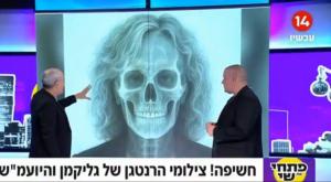 צילום ה"רנטגן" של בהרב מיהרה צילום: צילום מסך טלוויזיה