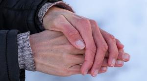 עור יבש צילום: movchanzemtsova,Shutterstock אופנה