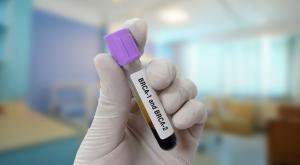בדיקת BRCA, אילוסטרציה |  צילום: Innovative Creation,Shutterstock חדשות