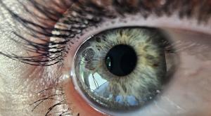 גלאוקומה צילום: NadjaKA,Shutterstock כדאי לדעת