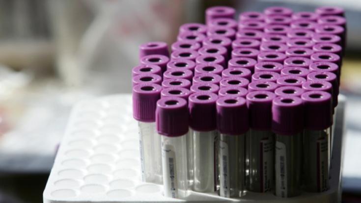 המדינה תומכת&nbsp;בחקירות DNA לבירור יהדות