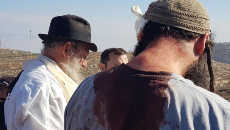 המשטרה: ניסיון הלינץ' בטיול בר המצווה - פעולת איבה