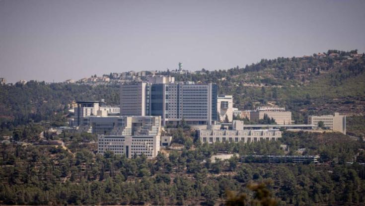 בית החולים הירושלמי שובר שיא: 12 השתלות בשבועיים