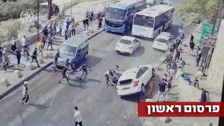 פצוע הלינץ' דורש מהמשטרה: עצרו את המחבלים שניסו לרצוח אותי