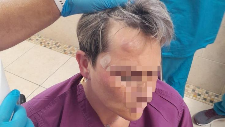 האלימות נגד צוותי רפואה נמשכת: תקיפה בבית החולים רמב"ם בחיפה