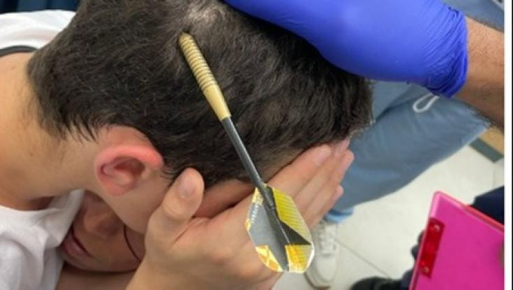הרופאים נדהמו: בן 12 הגיע למרפאה עם חץ תקוע בראשו
