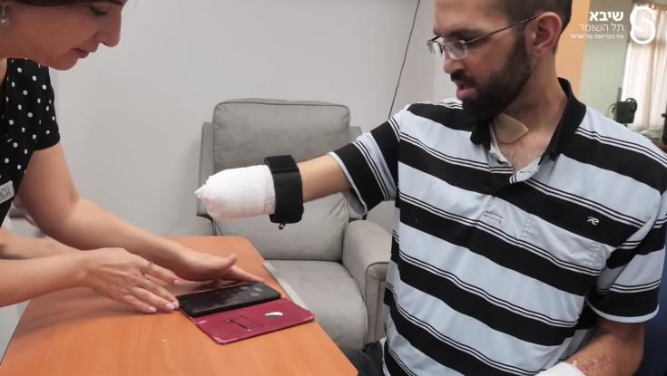 נפצע ממטען בשתי ידיו וחזר להשתמש בטלפון - זה הדבר הראשון שבדק