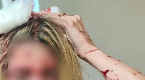 הרופאה שהותקפה בראשה בבאר יעקב צילום: ללא חדשות