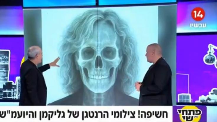 סערה בערוץ 14: המגישים פרסמו תמונות "רנטגן" של בהרב מיארה - וזה לא הכל