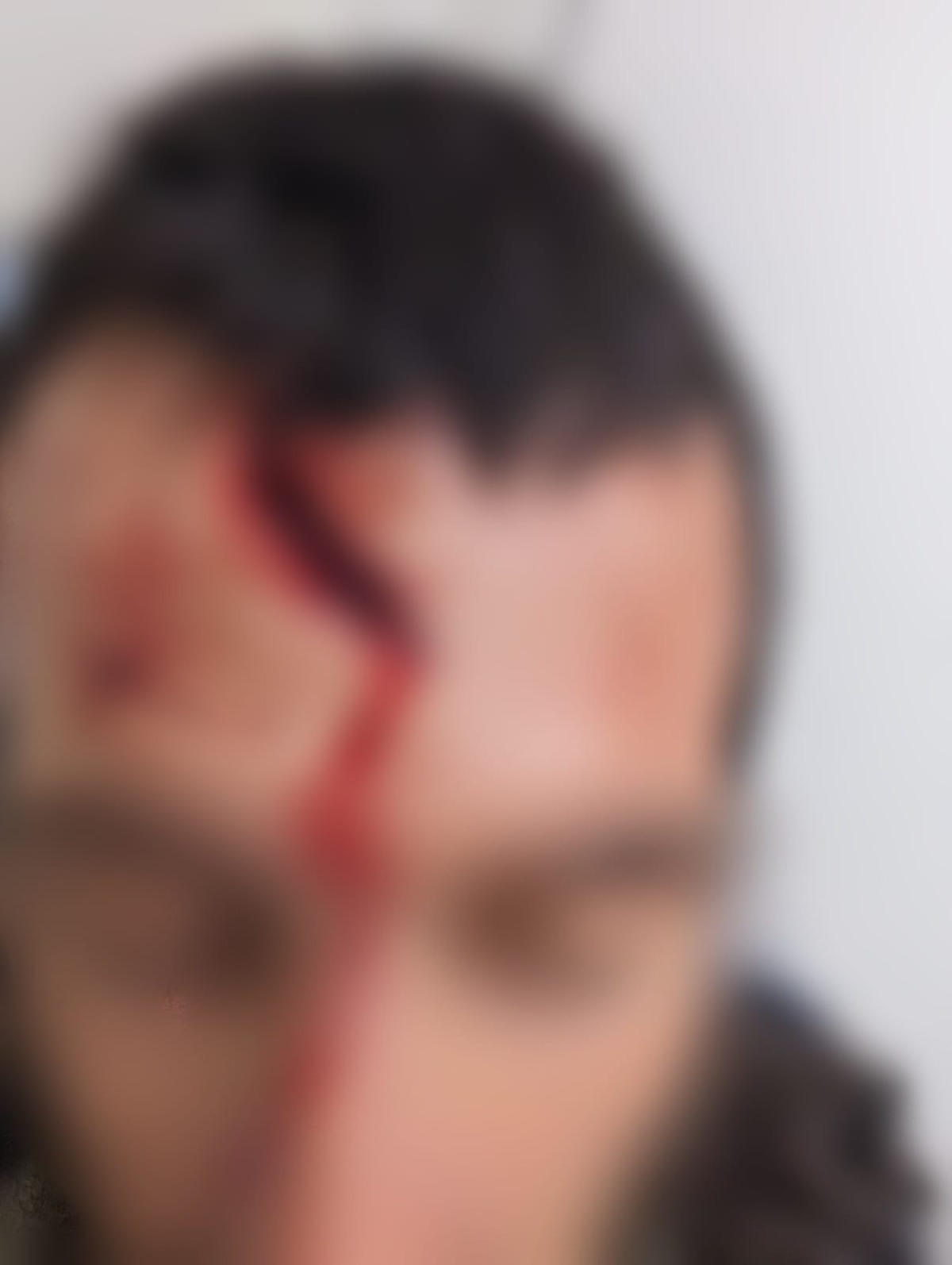 הפצוע בטרם הניתוח