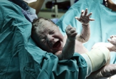 shutterstock צילום: shutterstock הריון ולידה